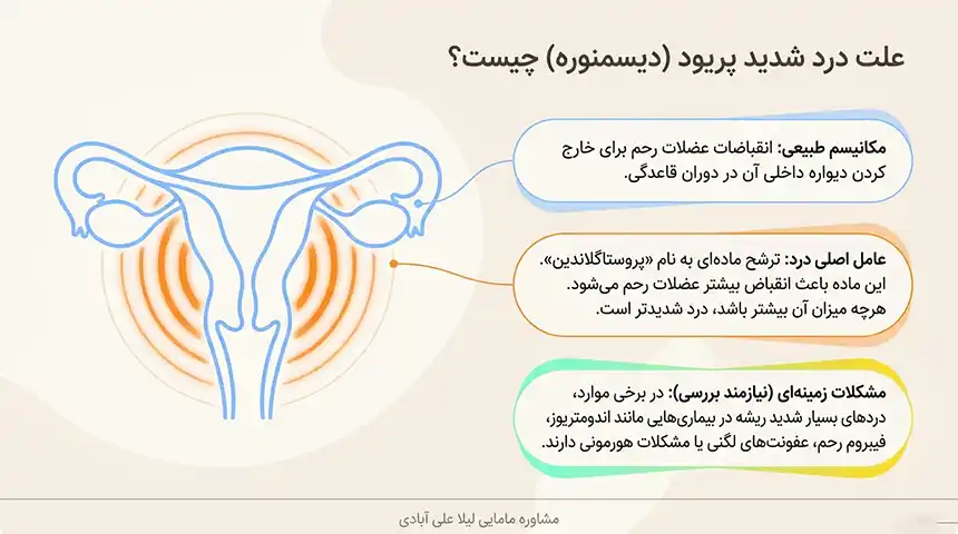 کاهش سریع درد پریود خانگی+کاهش سریع درد پریود در روز اول