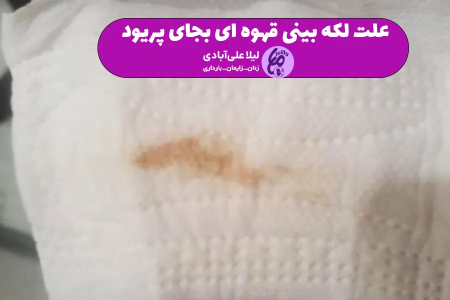 علت لکه بینی دو سه روز قبل از پریود