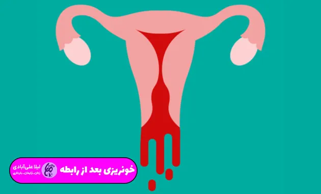 خونریزی بعد از رابطه