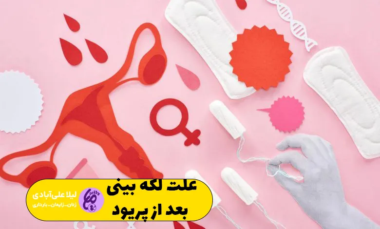 علت لکه بینی بعد از پریود