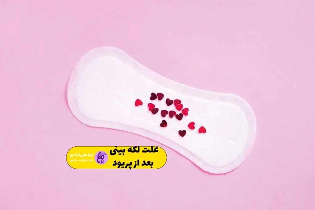 علت لکه بینی بعد از پریود
