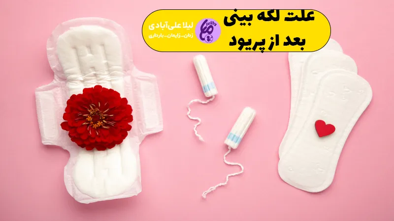 علت لکه بینی بعد از پریود