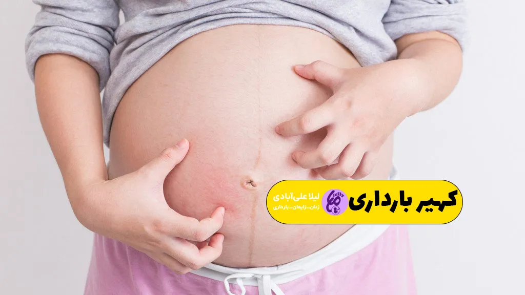 عکس کهیر در دوران بارداری