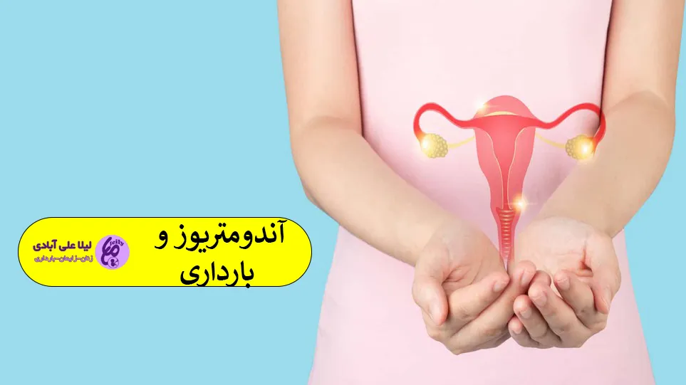 آندومتریوز و بارداری
