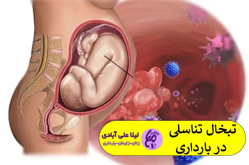 تبخال تناسلی در بارداری