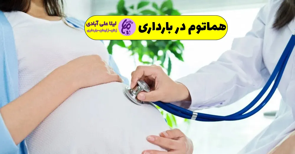 هماتوم در بارداری