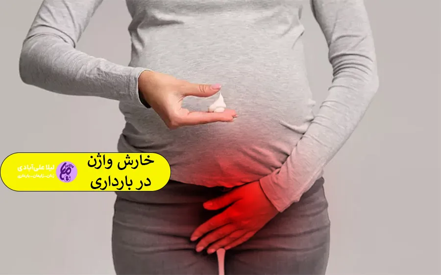 خارش واژن در بارداری