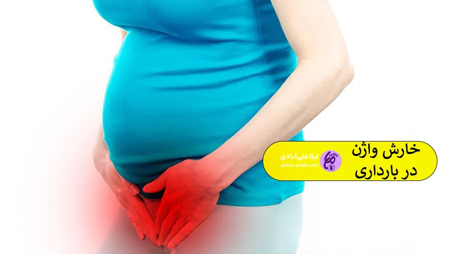 خارش واژن در بارداری