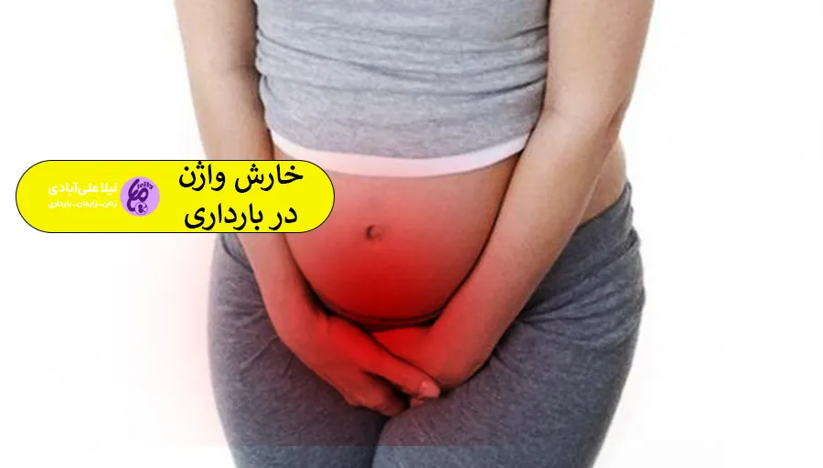 خارش واژن در بارداری