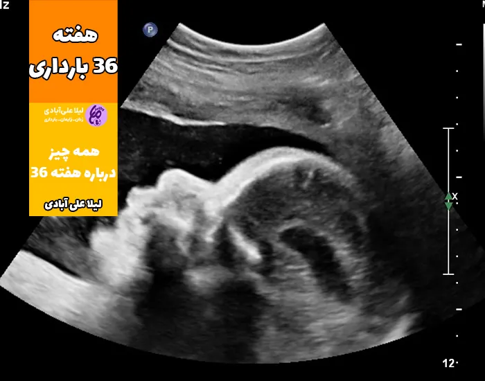 عکس جنین ۳۶ هفته
