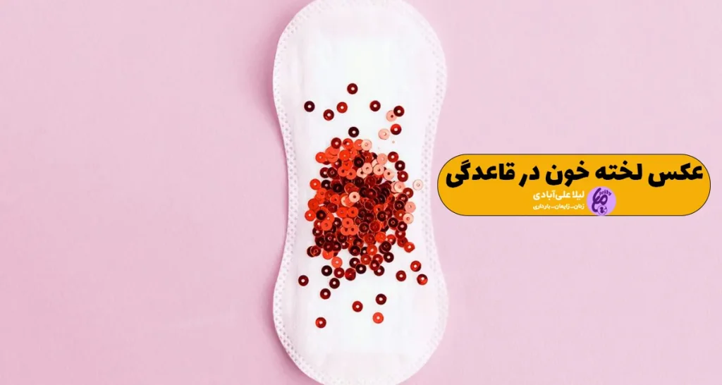 عکس لخته خون در قاعدگی
