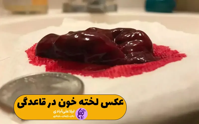 عکس لخته خون در قاعدگی