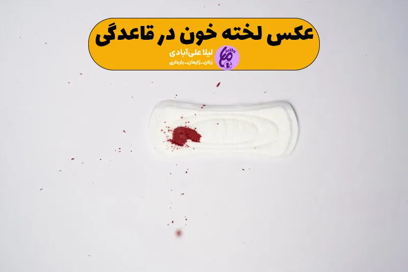 عکس لخته خون در قاعدگی