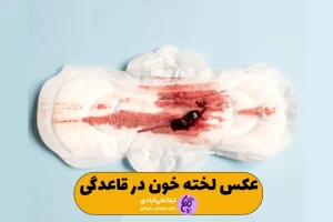 عکس لخته خون در قاعدگی