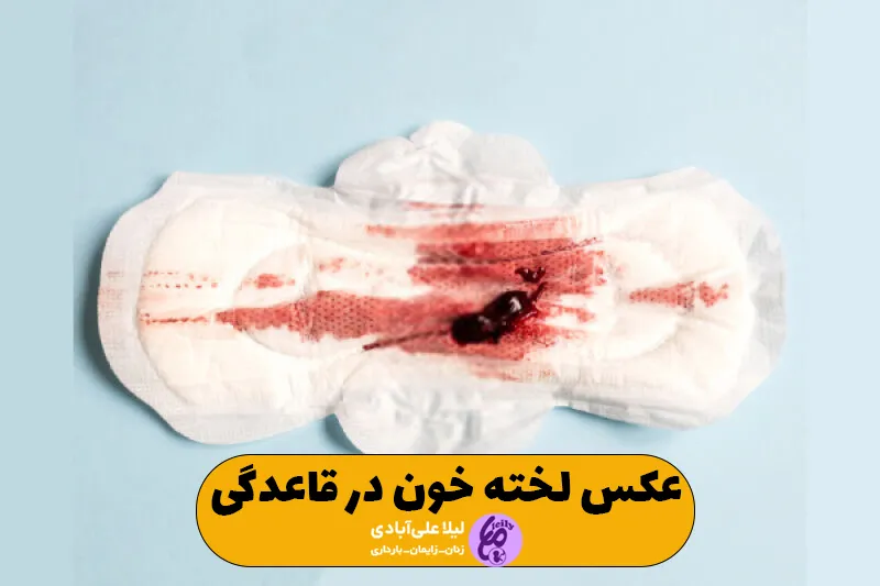 عکس لخته خون در قاعدگی