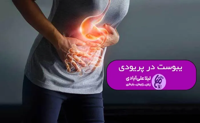 یبوست در پریودی