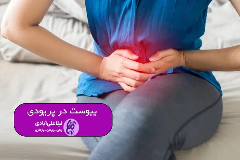 یبوست در پریودی