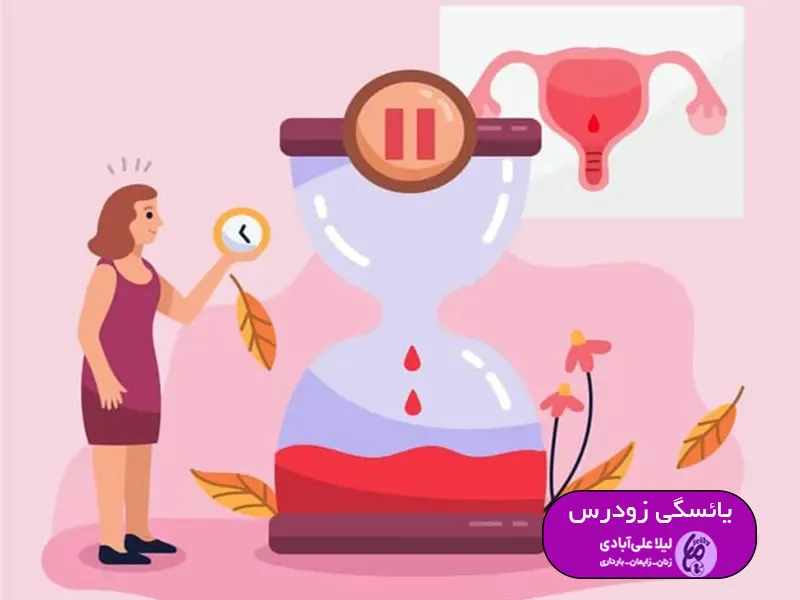 یائسگی زودرس