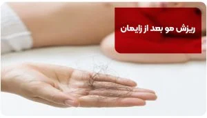 ریزش مو بعد از زایمان