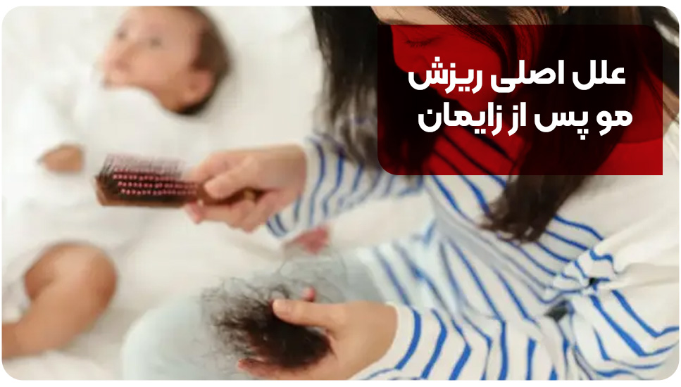 ریزش مو بعد از زایمان