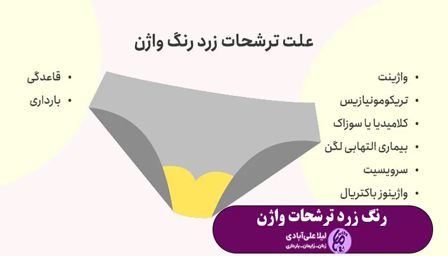 ترشحات زرد رنگ واژن