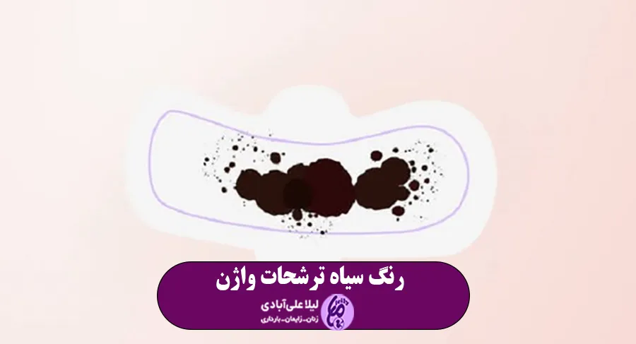 ترشحات سیاه رنگ واژن