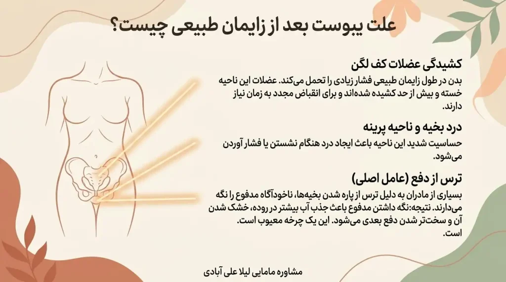 یبوست بعد از زایمان