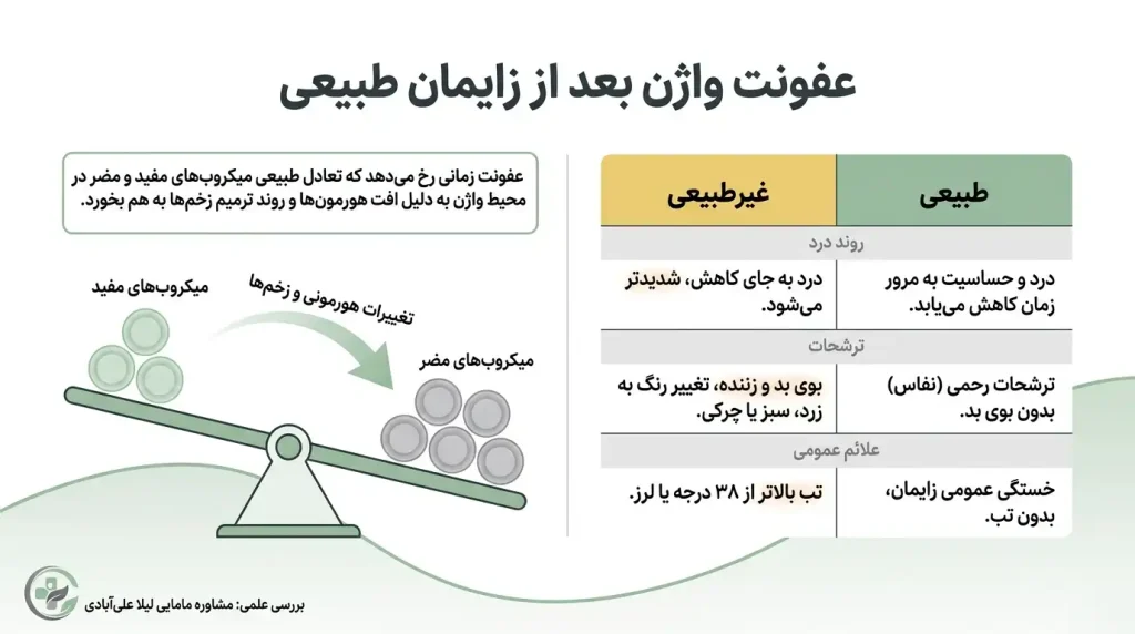 عفونت واژن بعد از زایمان طبیعی