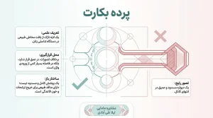 انواع پرده بکارت+پرده ارتجاعی