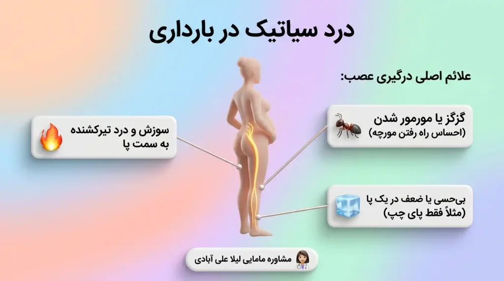 درد سیاتیک در بارداری