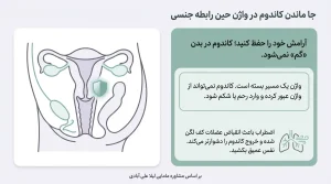 جا ماندن کاندوم در واژن حین رابطه جنسی