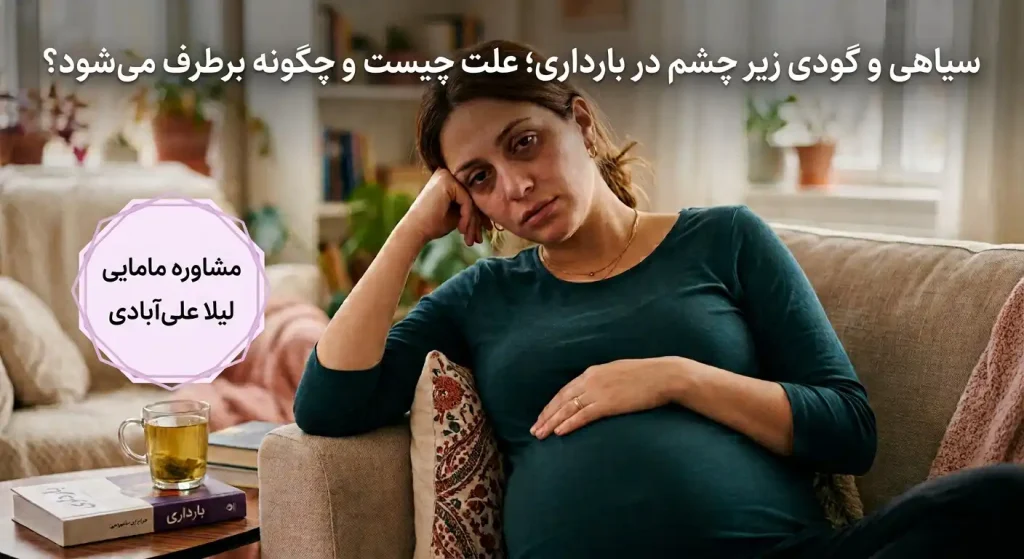 سیاهی زیر چشم در بارداری