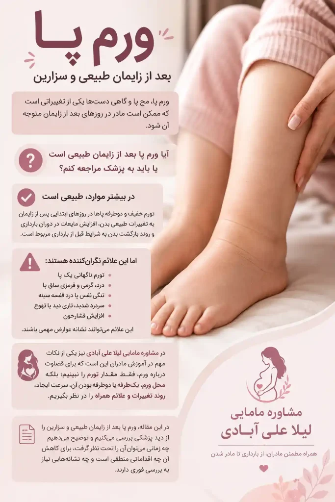 ورم پا بعد از زایمان طبیعی و سزارین