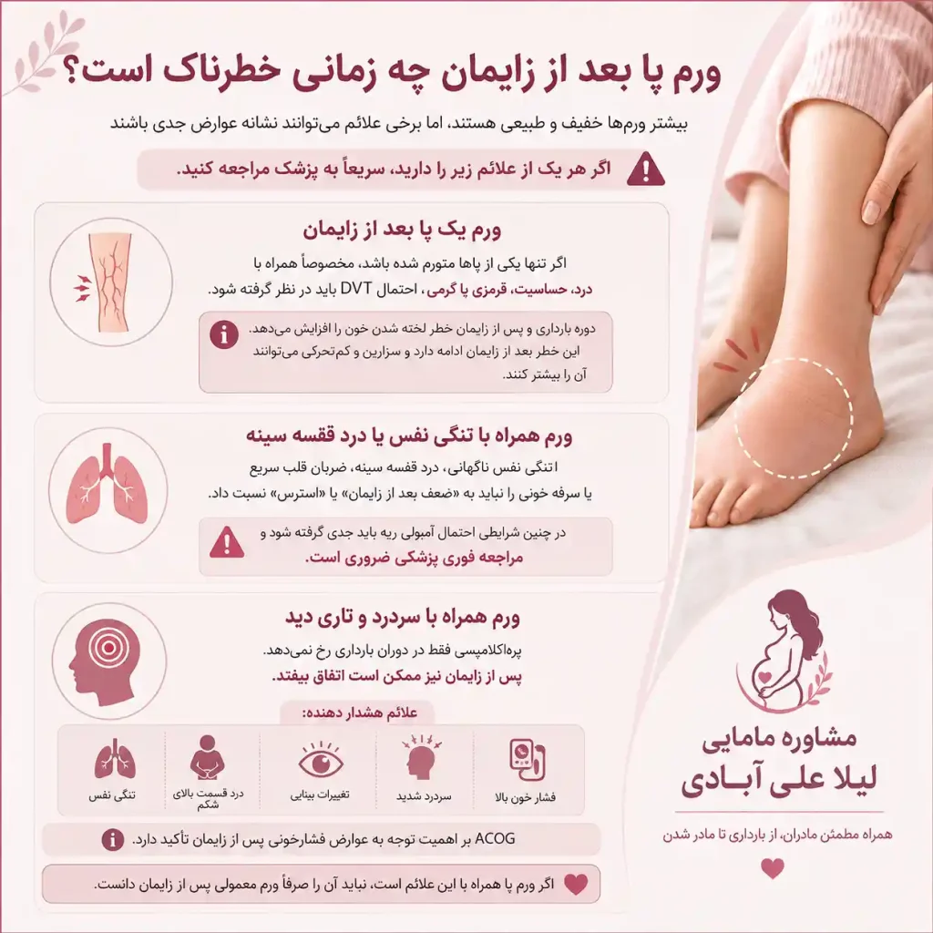 ورم پا بعد از زایمان طبیعی و سزارین