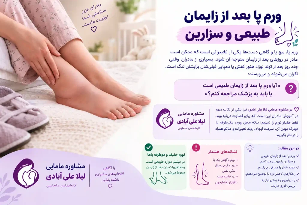 ورم پا بعد از زایمان طبیعی و سزارین