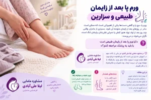 ورم پا بعد از زایمان طبیعی و سزارین