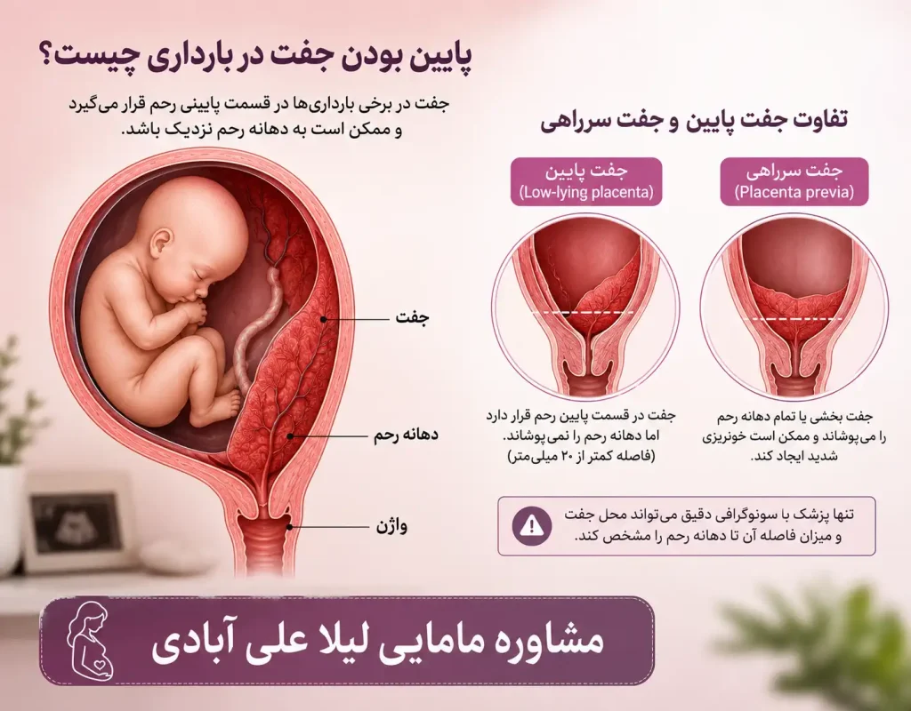 پایین بودن جفت در بارداری
