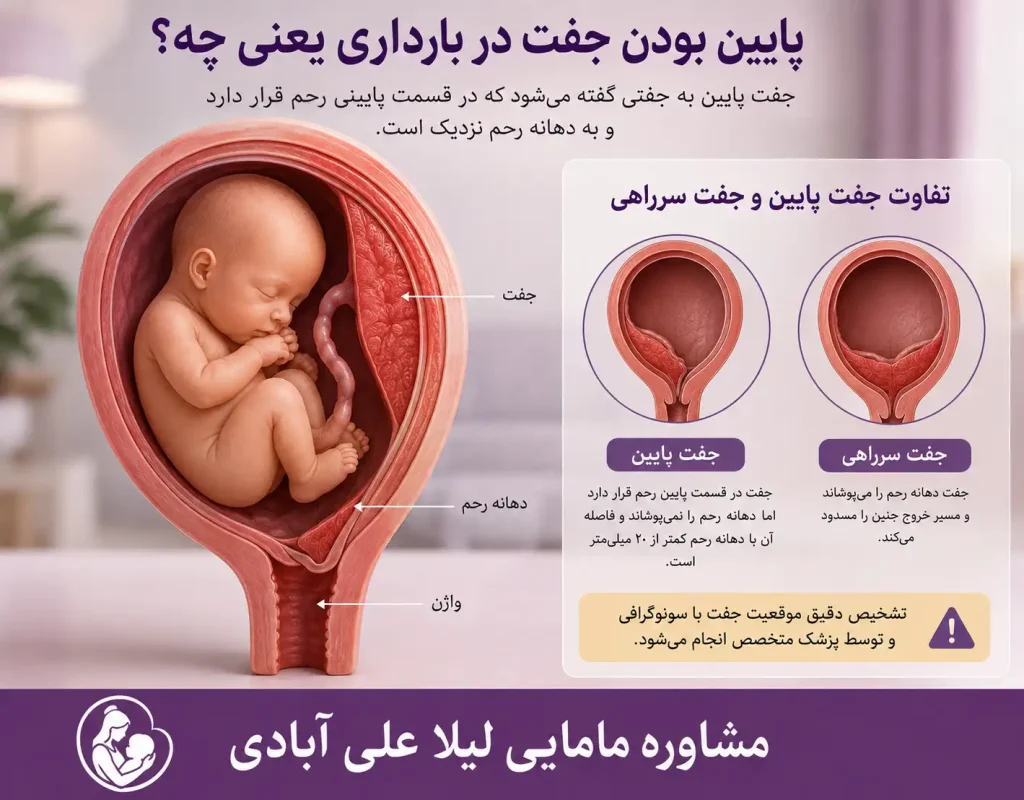 پایین بودن جفت در بارداری