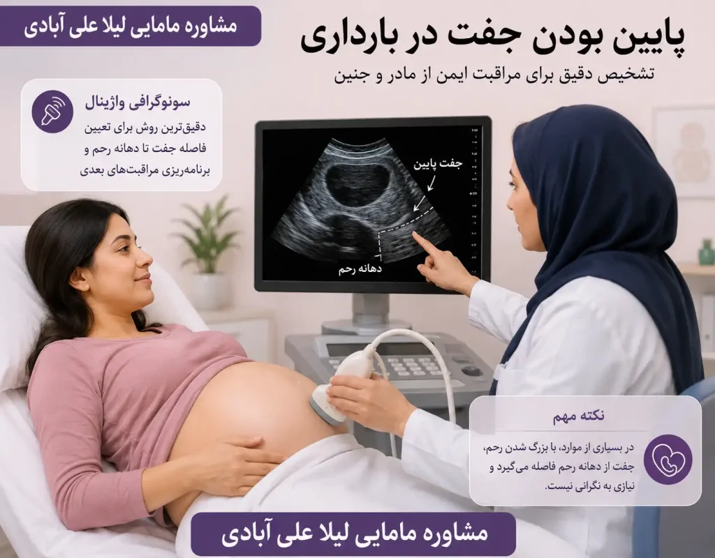 پایین بودن جفت در بارداری