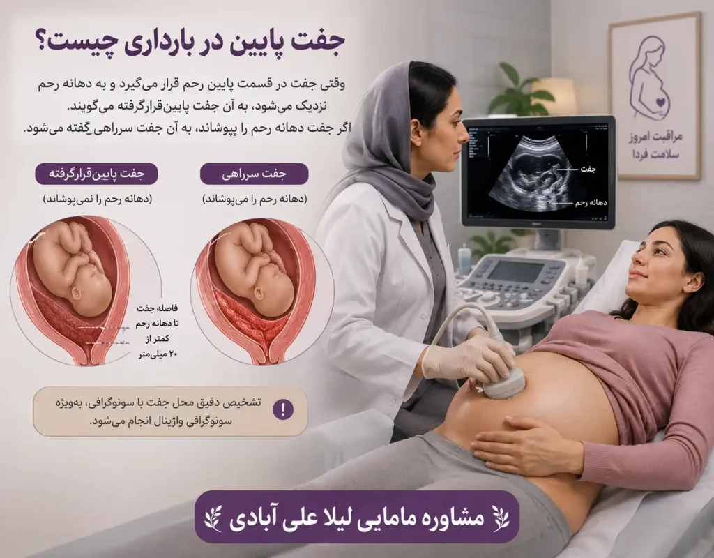 پایین بودن جفت در بارداری