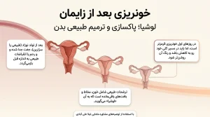 خونریزی بعد از زایمان
