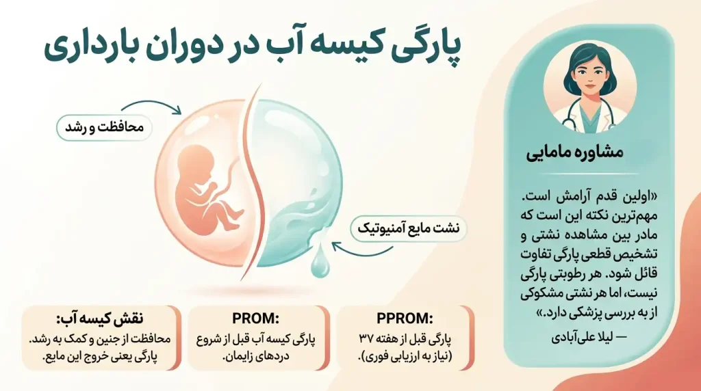 پارگی کیسه آب در بارداری