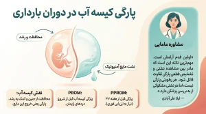 پارگی کیسه آب در بارداری