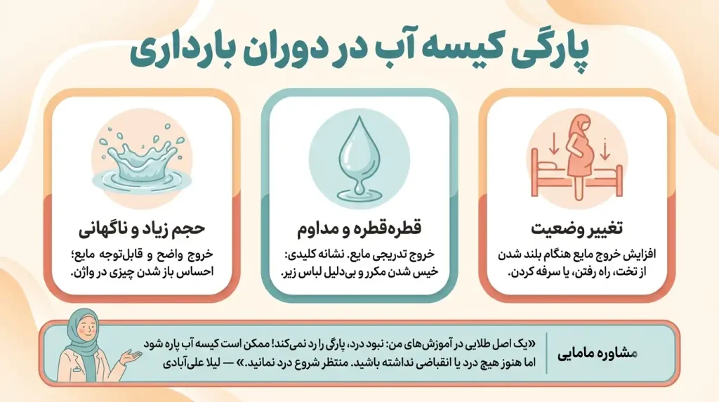 پارگی کیسه آب در بارداری