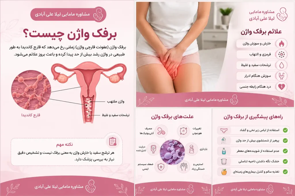 برفک واژن چیست