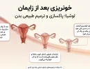 خونریزی بعد از زایمان
